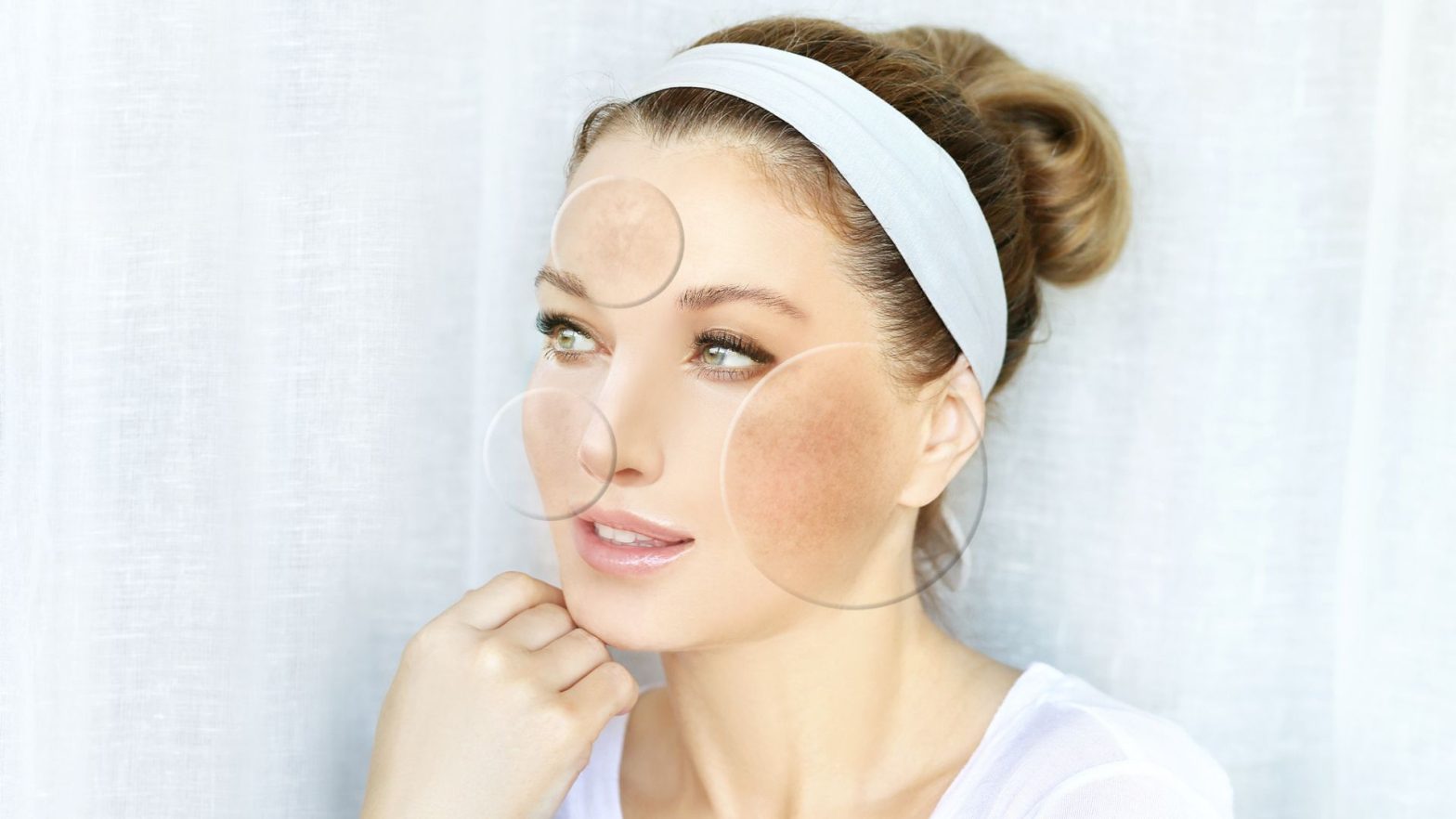 Melasma spot pigmentation